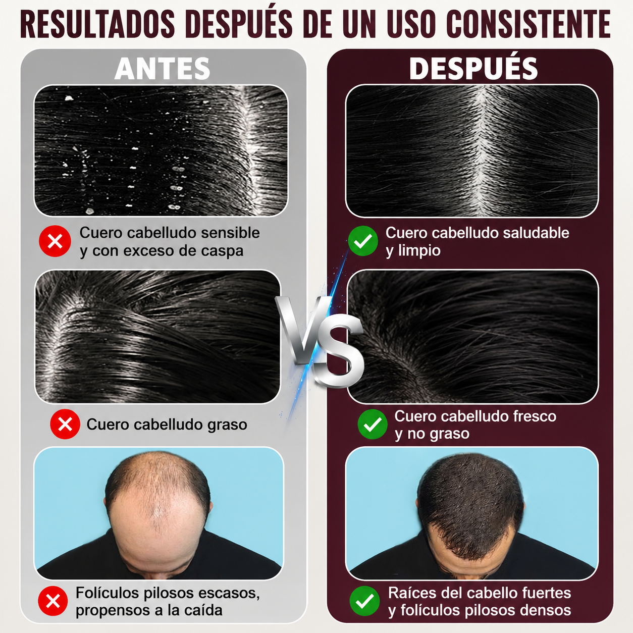 Peine de crecimiento del cabello con terapia láser, aplicador de aceite para el cabello, masajeador eléctrico para el cuero cabelludo