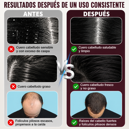 Peine de crecimiento del cabello con terapia láser, aplicador de aceite para el cabello, masajeador eléctrico para el cuero cabelludo